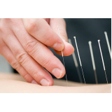 acupuntura para ansiedade Lado sul