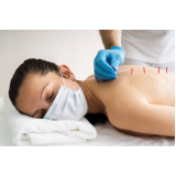 acupuntura para dor nas costas preços Asa norte