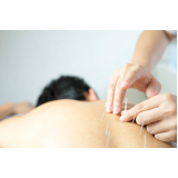 acupuntura para dor nas costas Condomínio Comunidade E Residencial Sobradinh