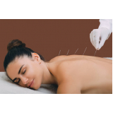 preço de acupuntura para dor nas costas Octogonal