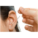 sessão de acupuntura auricular Setor Placa da Mercedes Nucle (Núcleo Bandeir